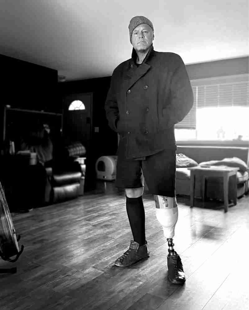 Scotty Roberts standing at home on his prosthetic leg
